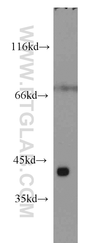 19736-1-AP;mouse heart tissue
