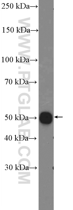 20201-1-AP;fetal human brain tissue