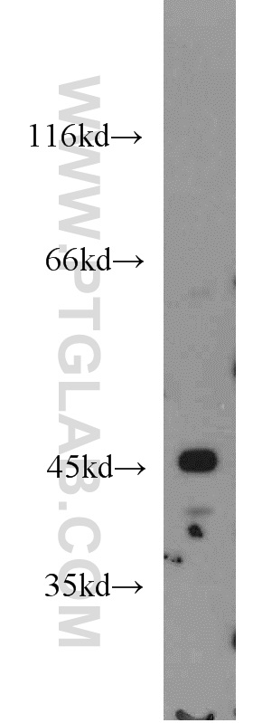 16223-1-AP;HeLa cell