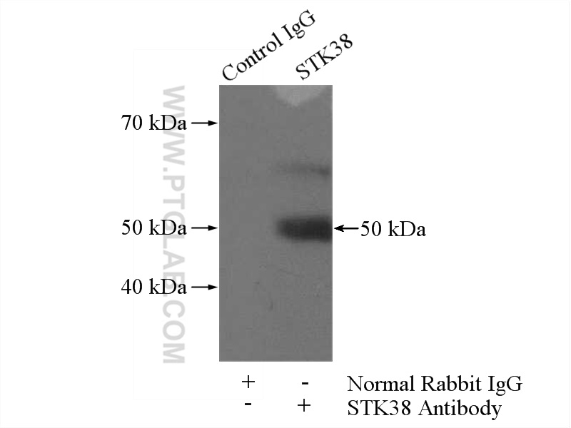 11105-1-AP;MCF-7 cells