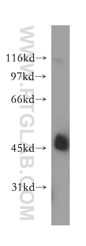 12862-1-AP;A375 cell