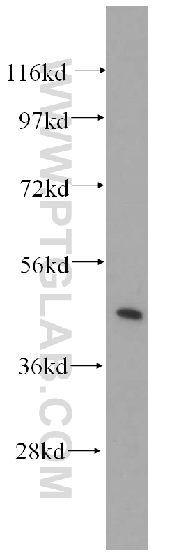 11201-1-AP;human kidney tissue