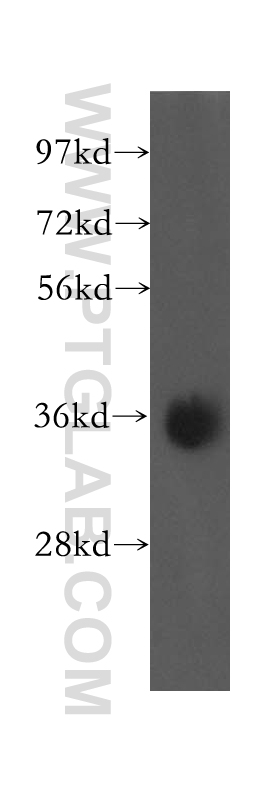 12322-1-AP;human liver tissue