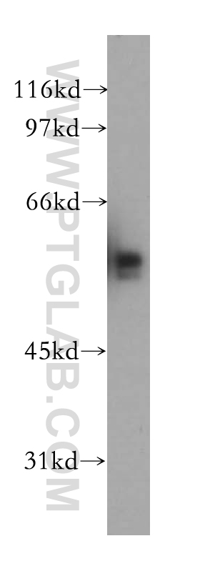 13506-1-AP;Jurkat cell