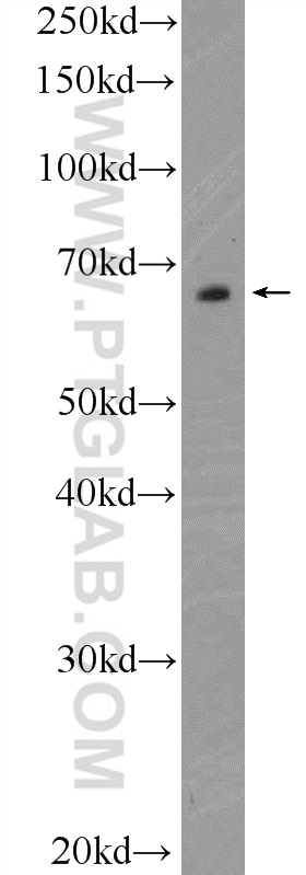 12418-1-AP;MDA-MB-453s cells
