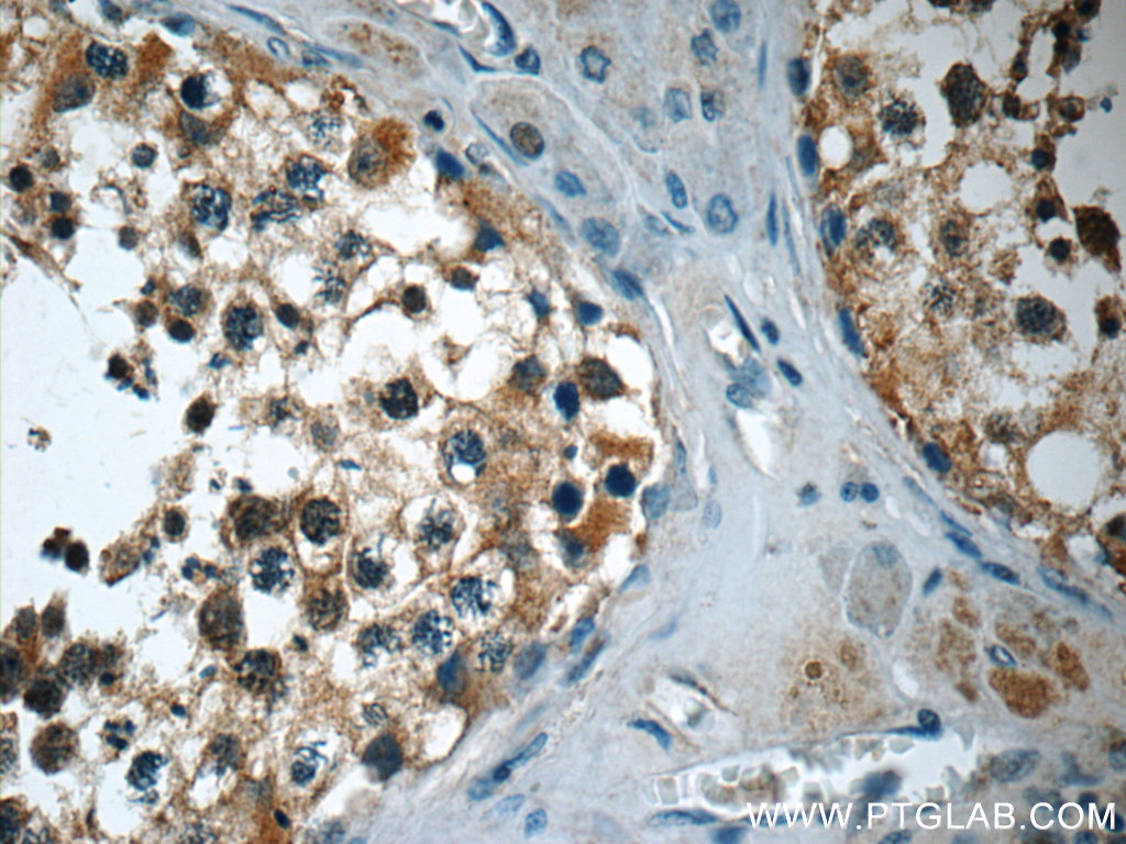 12959-1-AP;human testis tissue