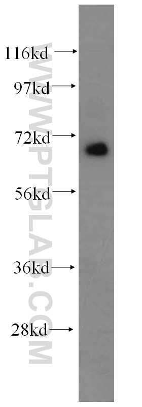 14480-1-AP;K-562 cell