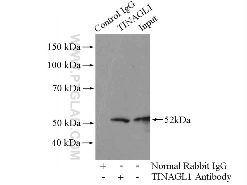 12077-1-AP;mouse heart tissue