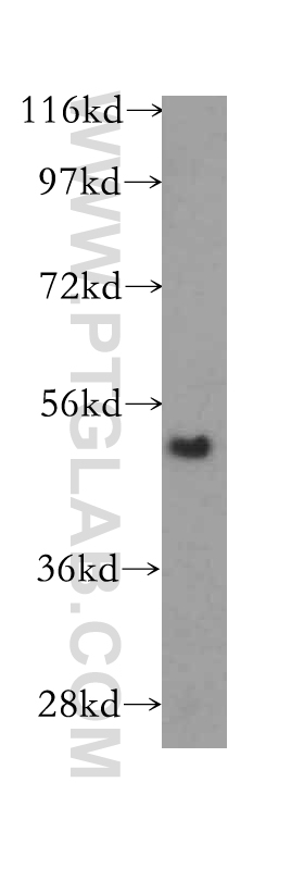 12077-1-AP;human placenta tissue