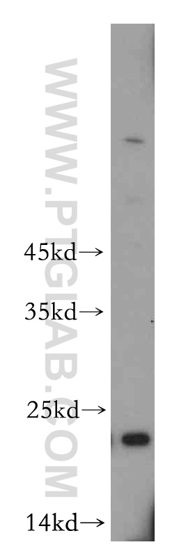 11981-1-AP;mouse pancreas tissue