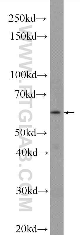 25505-1-AP;HepG2 cells