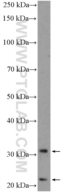 19825-1-AP;A549 cells