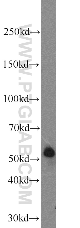 14437-1-AP;COLO 320 cells