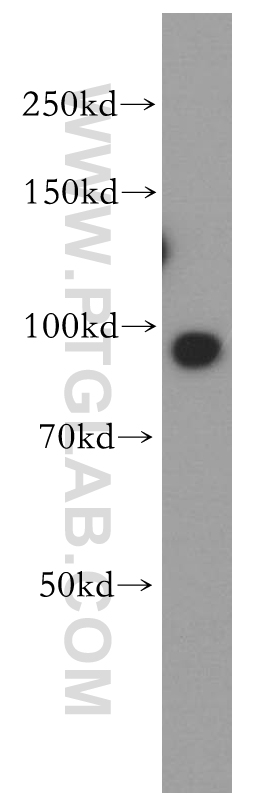 17831-1-AP;HeLa cell
