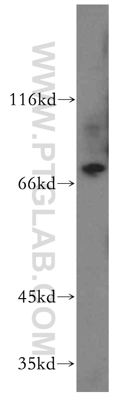11580-1-AP;human placenta tissue