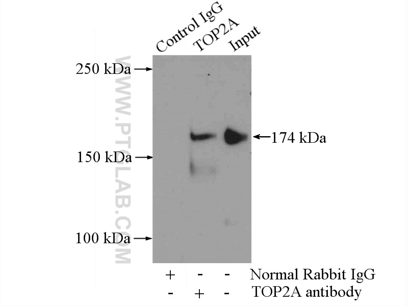 20233-1-AP;HeLa cells