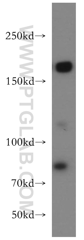 20233-1-AP;HeLa cell