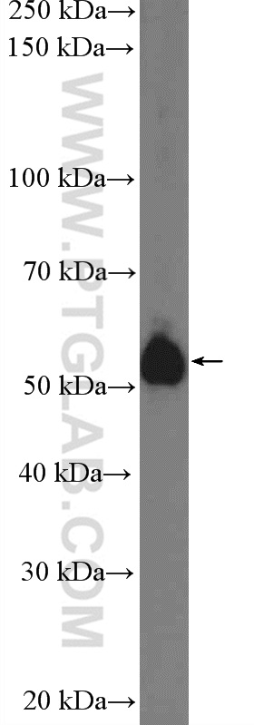 26285-1-AP;mouse heart tissue