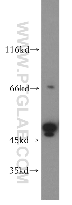 18255-1-AP;Jurkat cell