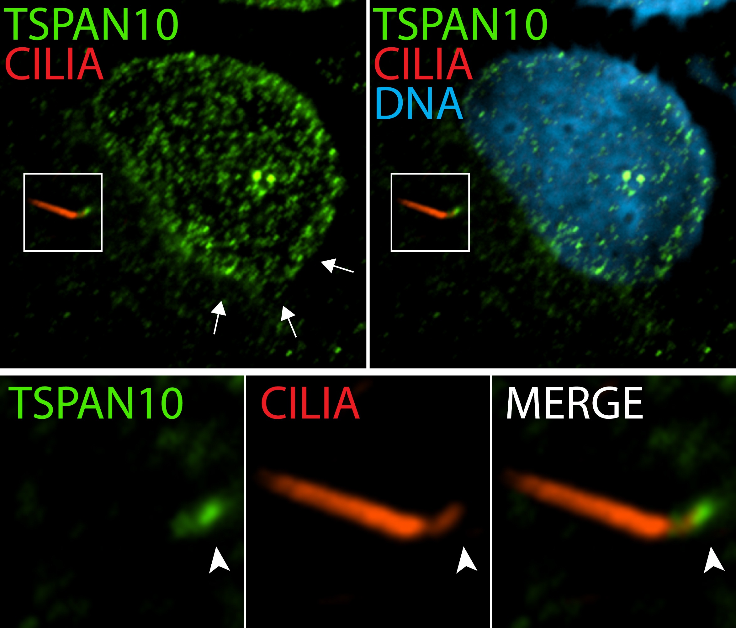 14430-1-AP;hTERT-RPE1 cells