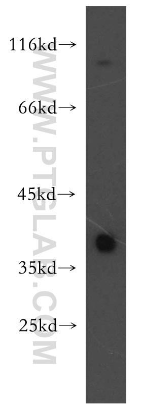 12122-1-AP;human brain tissue