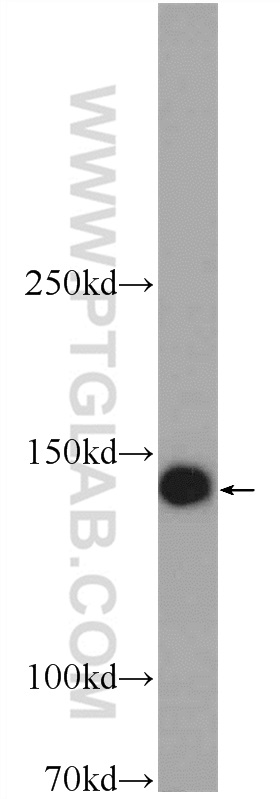 24594-1-AP;HeLa cells