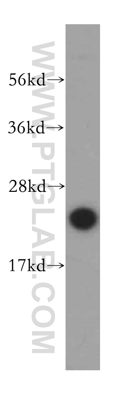 14115-1-AP;MDA-MB-453s cells