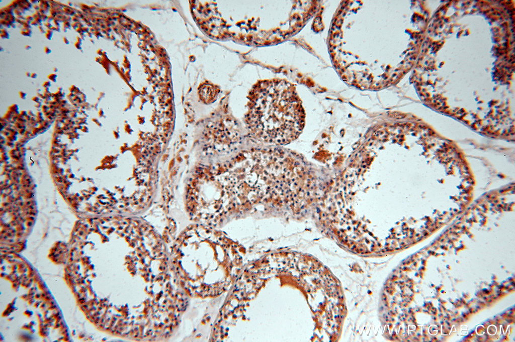18844-1-AP;H-testis