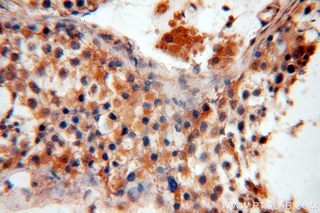 18844-1-AP;H-testis