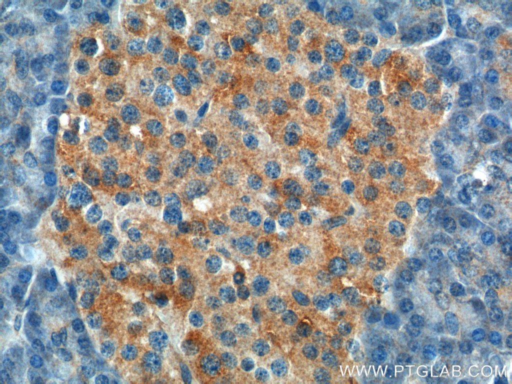 26069-1-AP;human pancreas tissue