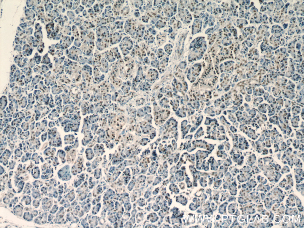 18853-1-AP;human pancreas tissue