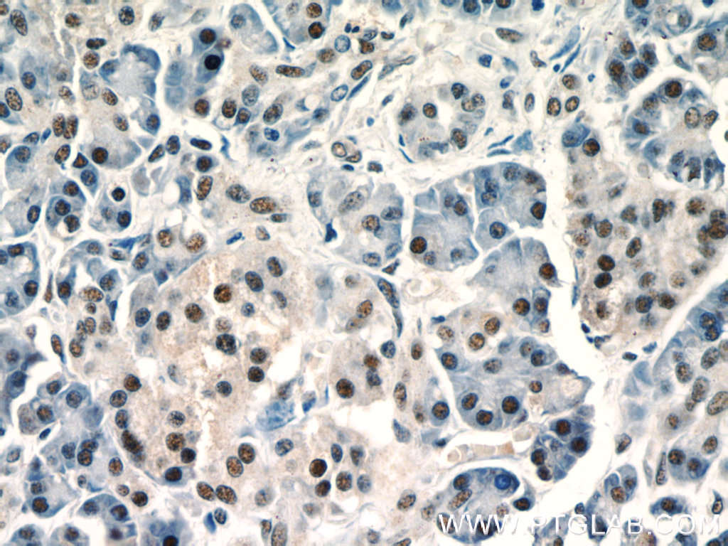 18853-1-AP;human pancreas tissue
