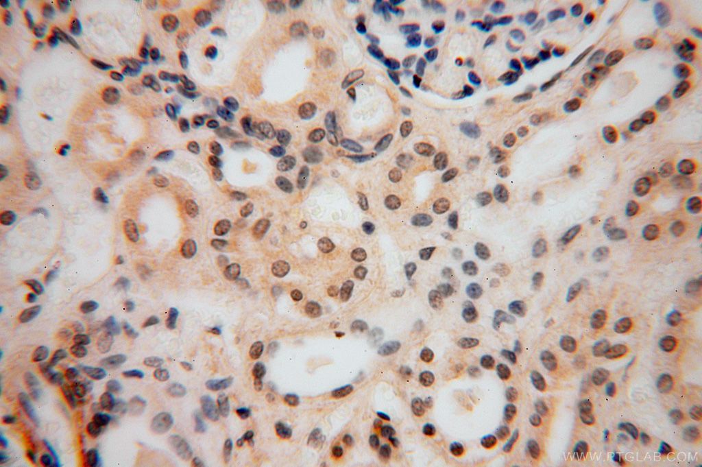 17005-1-AP;human kidney