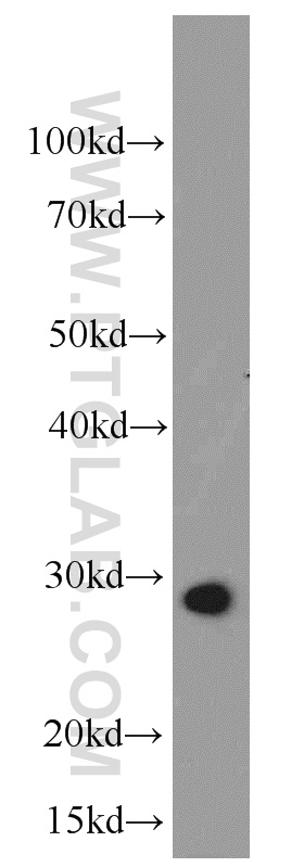 11081-1-AP;mouse skeletal muscle tissue