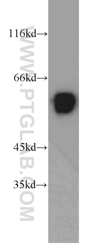 23301-1-AP;Jurkat cells