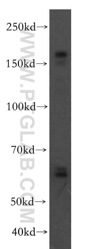 19493-1-AP;MCF7 cell