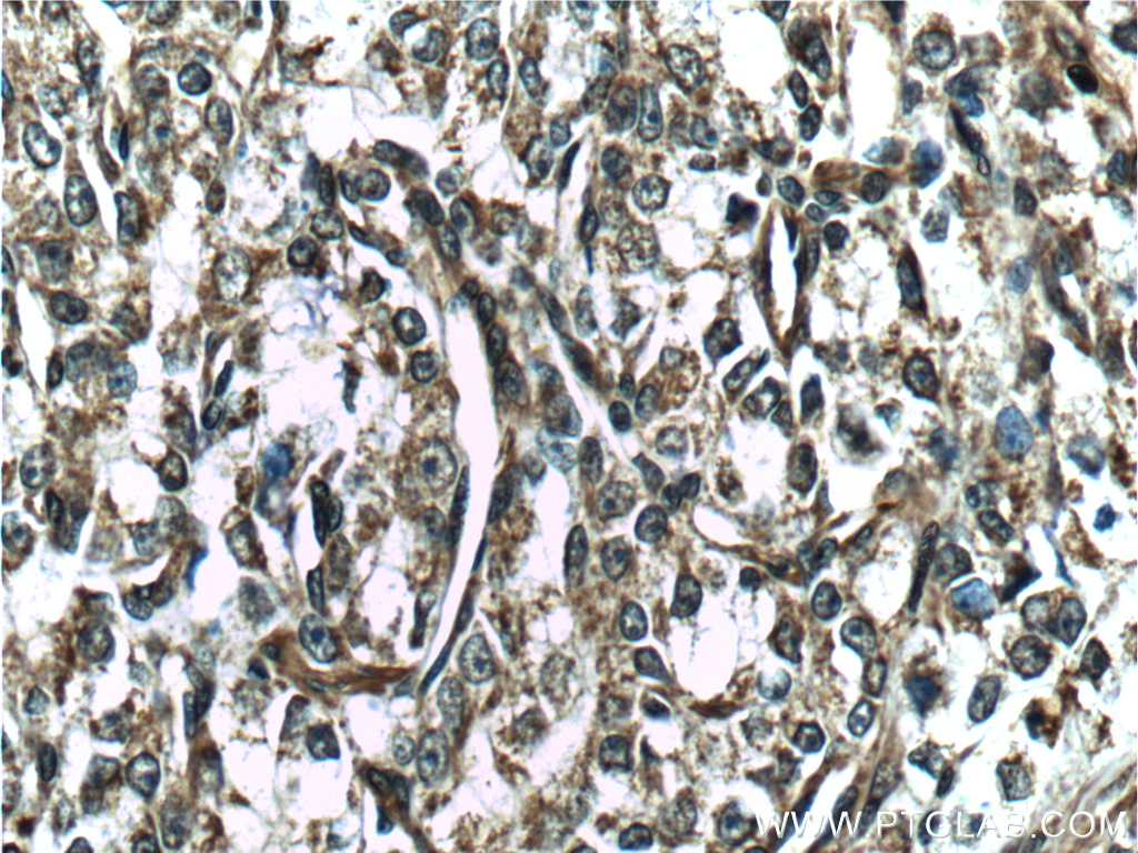 vinculin-antibody-26520-1-ap-proteintech