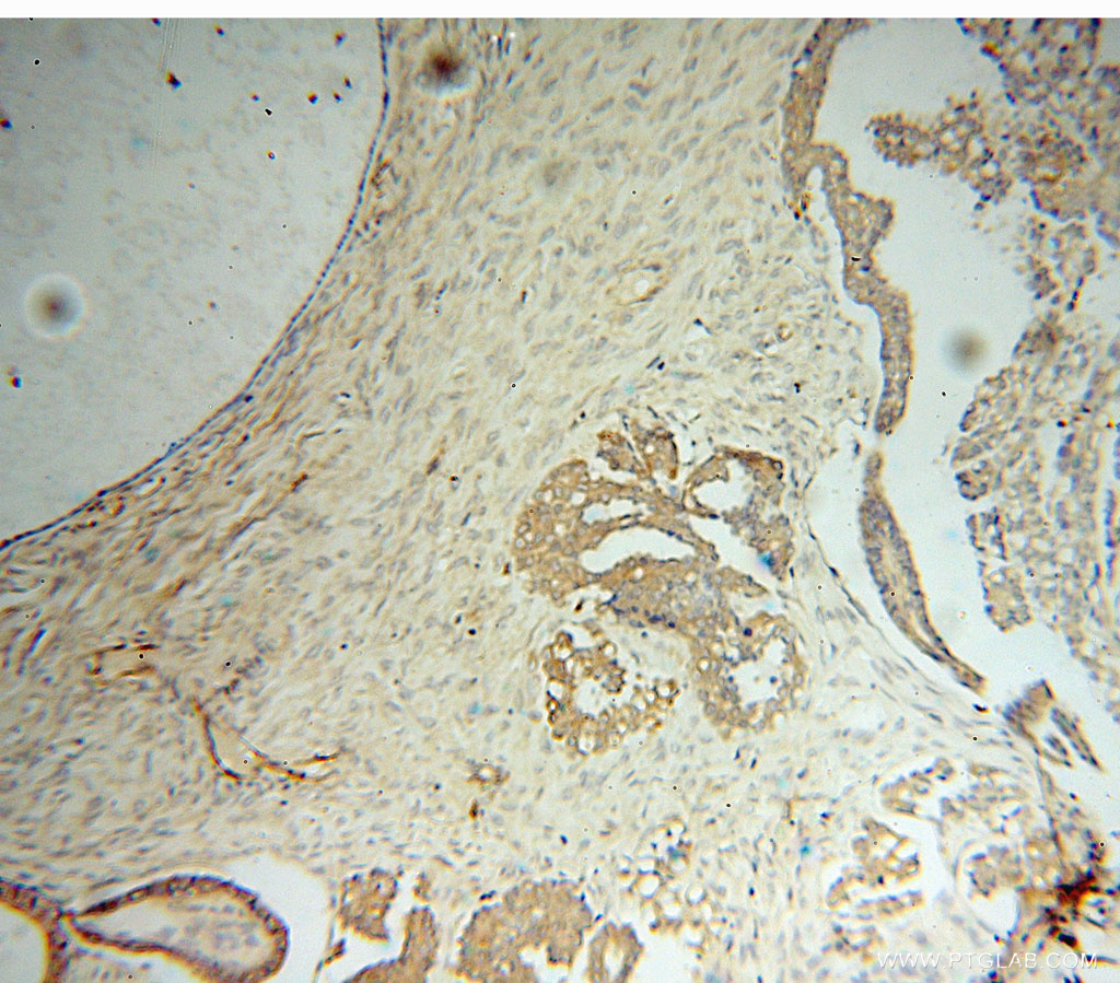16081-1-AP;human ovary tumor