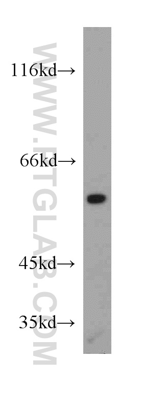 20916-1-AP;HeLa cells