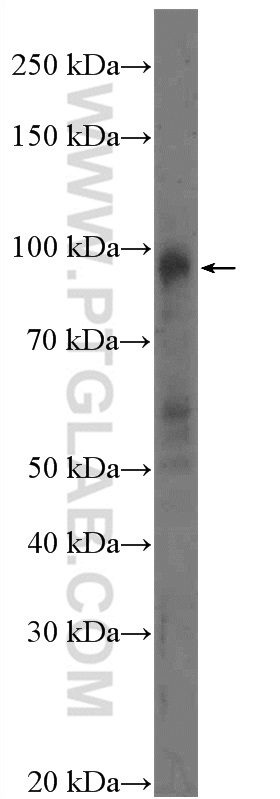 14375-1-AP;HeLa cells