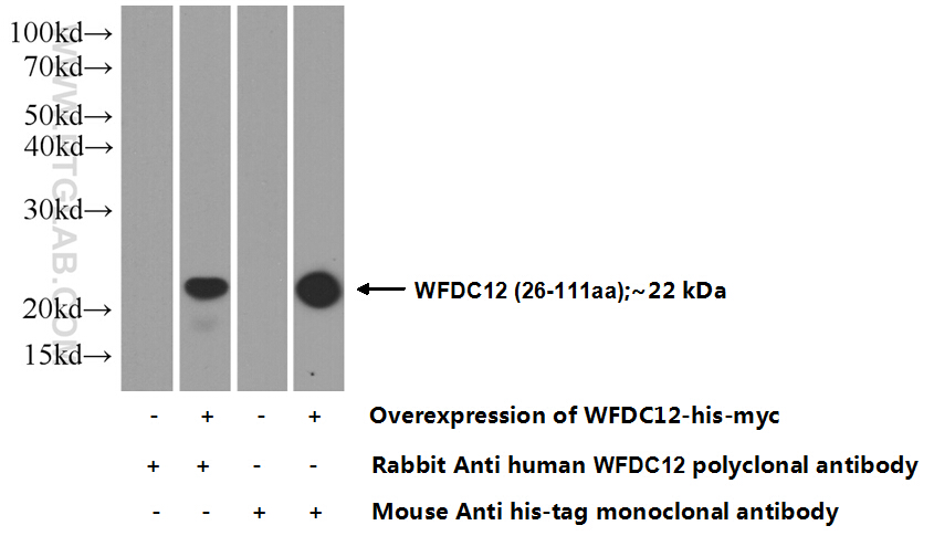 25101-1-AP;Transfected HEK-293 cells