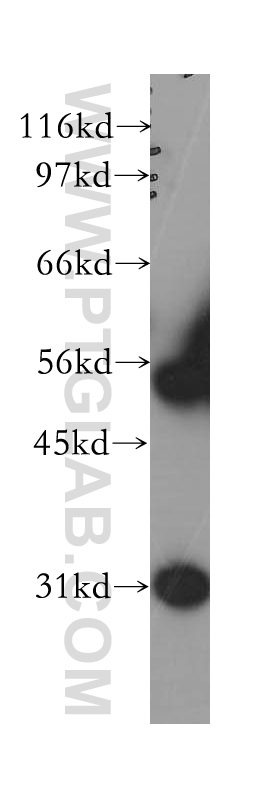 12609-1-AP;human kidney tissue