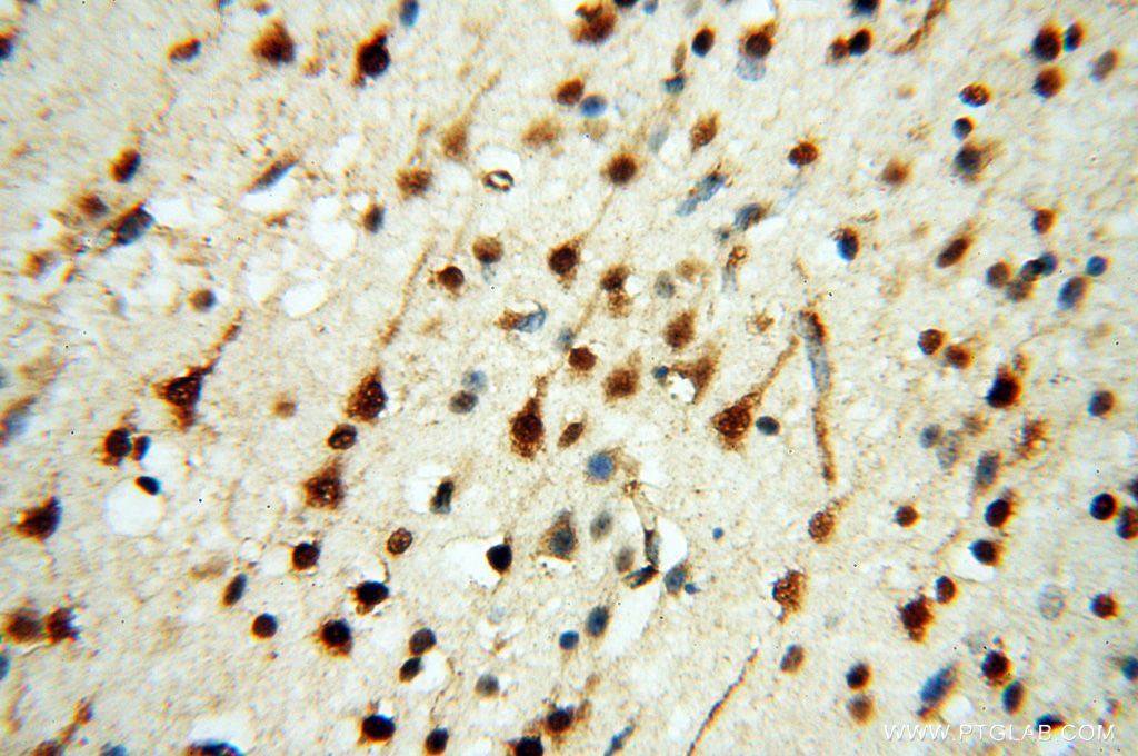 17479-1-AP;H-brain