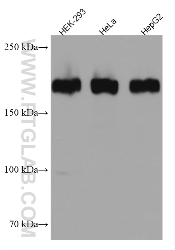 ZEB1 Antibody 662791Ig Proteintech