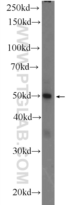 25515-1-AP;MCF-7 cells
