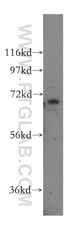 16618-1-AP;HepG2 cell