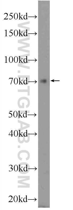 25299-1-AP;HepG2 cells