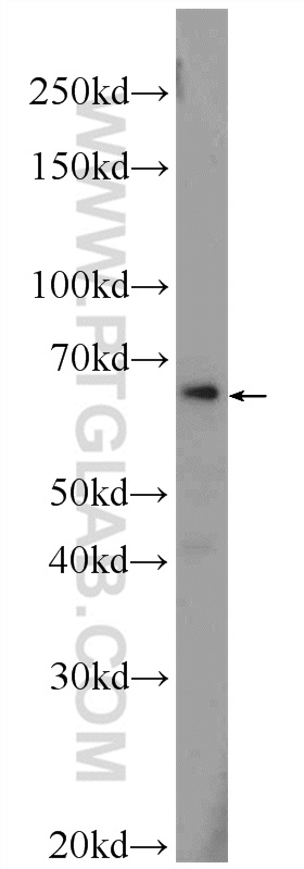 25449-1-AP;HepG2 cells