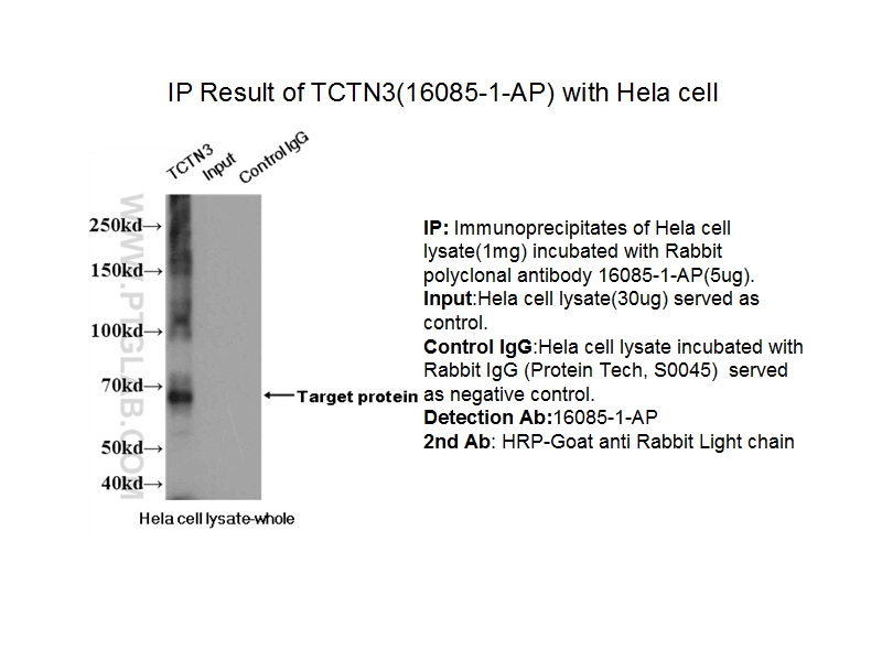 http://www.ptgcn.com/products/Pictures/TCTN3-Antibody-16085-1-AP-A232IP.jpg