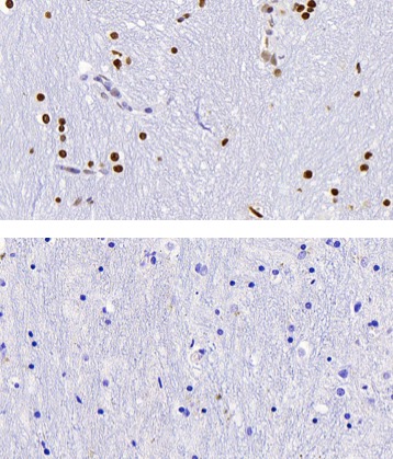 5-Hydroxymethylcytosine (5-hmc) antibody (pAb) tested by Immunohistochemistry Punctate nuclear staining pattern is detected in Formalin-fixed, paraffin-embedded tissue sections from human substantia nigra (midbrain). Top Panel: 5-mC antibody at 1:1000 dilution. Bottom Panel: No primary antibody (2nd step antibody alone)